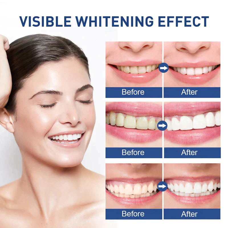 Frosty Teeth Pen Members area